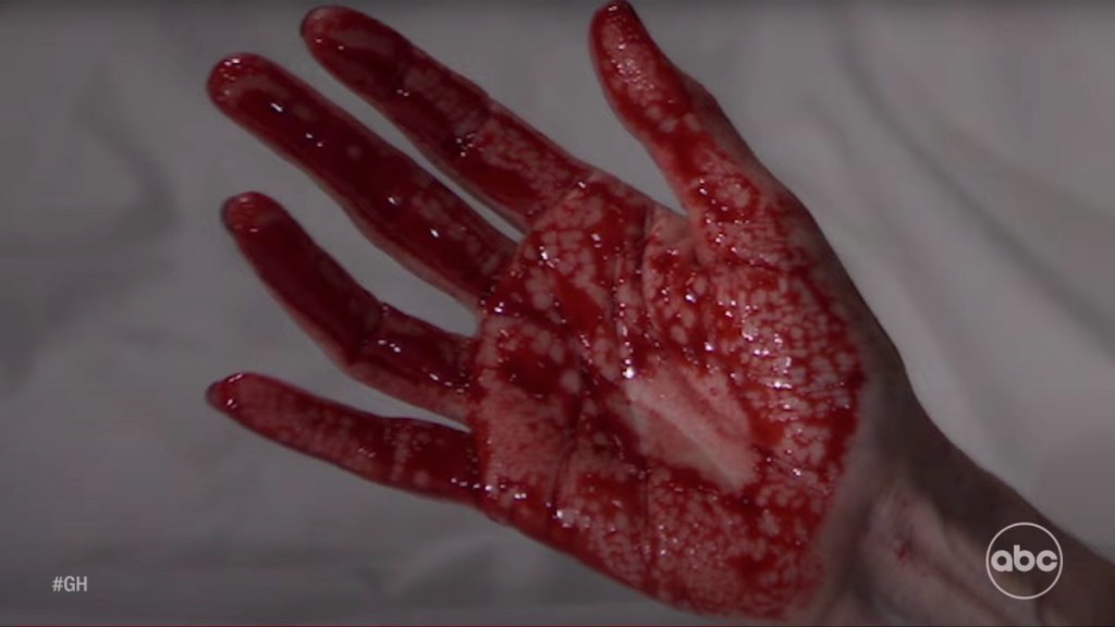 GH bloody hand